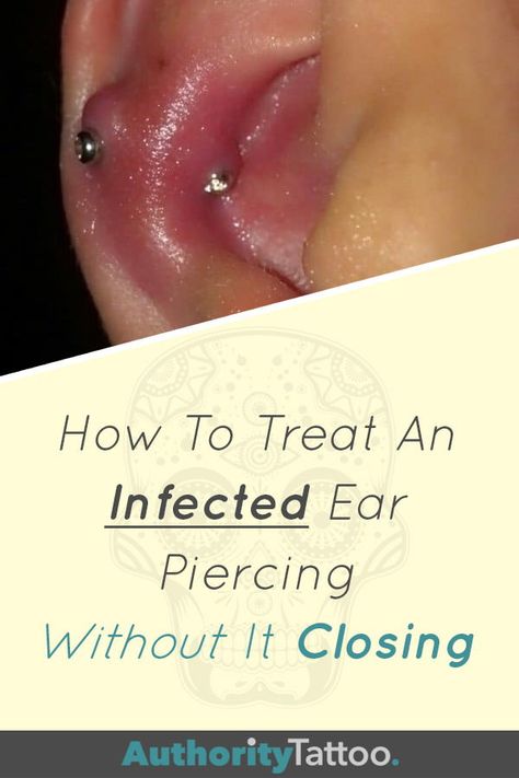 Nobody wants a piercing to close due to infection. Treating infections efficiently will spare you further complications. Click the pin to learn how to save your piercing. Ear Piercing Infection Remedy For Kids, Piercing Bump Remedy How To Get Rid, Piercing Bump Remedy, Cartilage Piercing Infection, Infected Ear Piercing, Ear Piercing Care, Piercing Bump, New Ear Piercing, Piercing Care