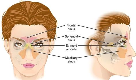 With millions of Americans struggling with chronic sinus issues, it would be helpful to know what causes most of them. Sinus Pressure Points, Sinus Headache Remedies, Relieve Sinus Congestion, Sinus Inflammation, Paranasal Sinuses, Maxillary Sinus, Remedy For Sinus Congestion, Sinus Cavities, Home Remedies For Sinus