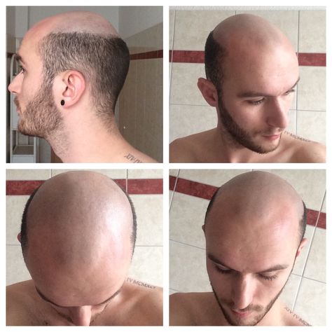 Male Pattern Baldness Hairstyles, Moustaches Men, Shaved Heads, Kinds Of Haircut, Flat Top Haircut, Bald Men Style, Bald Look, Male Pattern Baldness, Bald Man