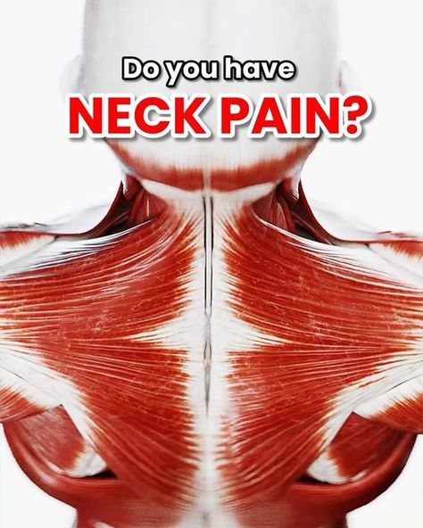 Back And Neck Stretches For Pain, Degenerative Disk In Neck Exercises, Stretches For Tech Neck, Yoga For Cervical Neck Pain, Exercise For Cervical Neck Pain, Neck Stretching, Neck Pain Exercises, Cervical Pain, Neck Tension