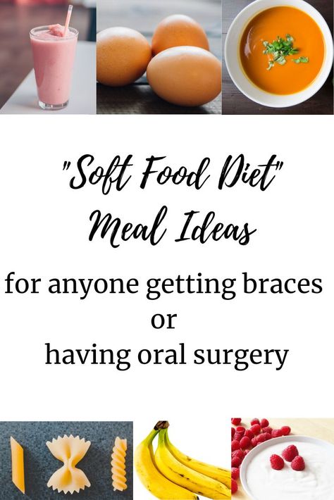 Easy Meals For Braces, Post Braces Food, Soft Food School Lunches, Brace Friendly Recipes, Meals For New Braces, Soft Foods To Eat After Getting Braces, Soft Foods For Braces Dinner, Braces Lunch Ideas, After Braces Food