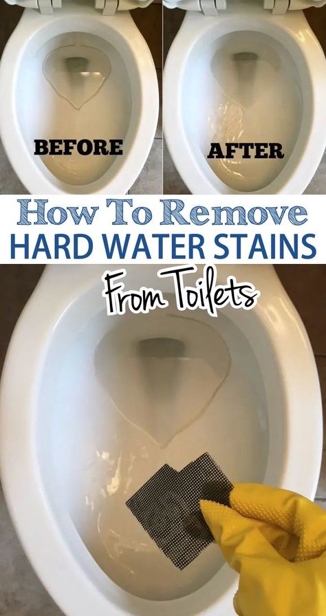 Hard Water Ring In Toilet, Ring In Toilet, How To Get Rid Of Water Stains On Wood, Remove Toilet Bowl Ring, Remove Ring From Toilet Bowl, Calcium Build Up Remover Toilet, Ring Around The Toilet, Toilet Ring Remover Hard Water, How To Remove Hard Water Stains Toilet