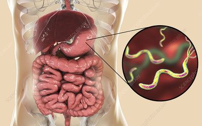 Bacteria Microscope, Rhizobium Bacteria, Binary Fission In Bacteria, Hereditary Spherocytosis, Gastrointestinal Disease, Cyanobacteria Under Microscope, Flora Intestinal, Stomach Ulcers, Medical News