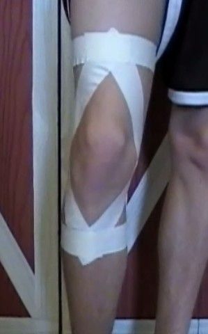 How to Tape a Knee How To Tape Knee For Support, How To Tape Knee For Pain, Knee Taping, Knee Pain Relief Remedies, Aching Knees, K Tape, Fake Injury, Healthy Heart Tips, Pain Relief Remedies