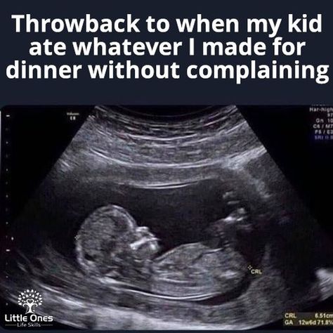 LittleOnes Life Skills on Instagram: “Throwback to when my #kid ate whatever I made for #dinner without complaining. 🤦‍♀️🤦‍♀️🥴 . 👉Follow @littleoneslifeskills 👈 . #love #family…” Throwback Quotes, Mom Memes, Parenting Memes, Kid Memes, Life Pictures, Parenting Humor, Real Women, True Stories, Really Funny