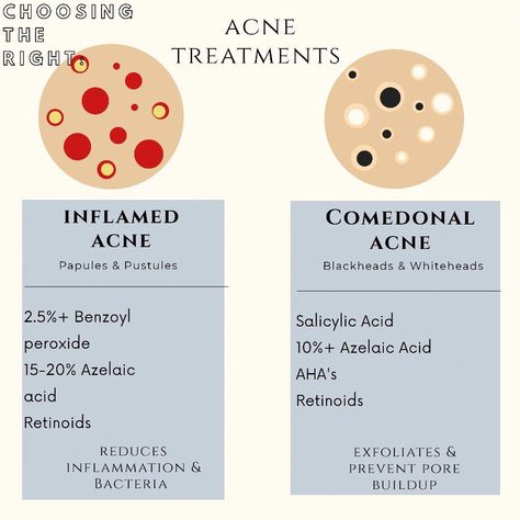 How To Treat Closed Comedones, Skincare For Closed Comedones, Closed Comedones Skin Care Routine, Closed Comedones Skin Care, Esthetician Knowledge, Closed Comedones, Comedonal Acne, Treating Cystic Acne, Esthetician Skincare