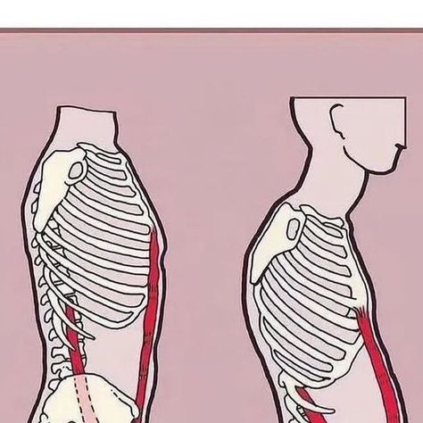 Backpain | Sciatica | Mobility on Instagram: "💪🏻 A set of exercises for a strong back! Keep this big post to yourself, like it and share it with your friends.

😌 For a strong back, it is not necessary to go to the gym. All you need is regular work on yourself! Do you agree with me? 

👇🏻Write in the comments, how often do you train?

By @makarin
#workout #exercise #back #backpain #fitness #pilates #strong" Back Release, Exercise For Back, Forward Head Posture Exercises, Exercise Weights, Exercise Back, Everyday Exercise, Low Back Pain Relief, Neck And Shoulder Muscles, Rehab Exercises