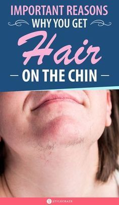 Chin Hair Causes, Chin Hair Removal For Women, Hair On Chin Women, Natural Facial Hair Removal, Thyroid Exercise, Chin Hair Removal, Nail Growth Tips, Face Hair Removal, Chin Hair