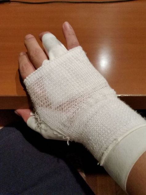 Fracture Hand Snapchat, Bandaged Hands, Cute Funny Pics, Cute Bear Drawings, Emotional Photography, Driving Photography, Instagram Ideas Photography, Best Poses For Men, Boy Photography Poses