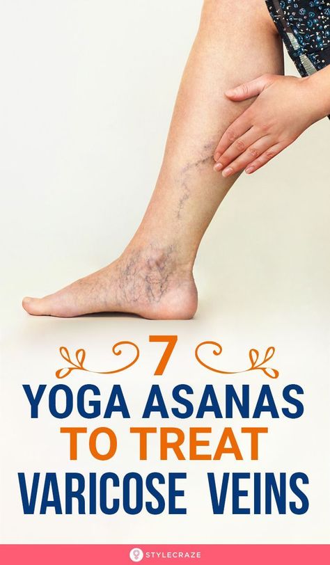 Vericous Veins, Abc Yoga, Importance Of Yoga, Stretches For Beginners, Yoga Positionen, Vein Health, Varicose Vein Remedy, Leg Veins, Release Negativity