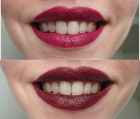 What Color Lipstick Makes Teeth Look Whiter? A Handy Guide To Getting Your Most Brilliant Smile Instantly | Bustle Lipstick That Makes Teeth Look Whiter, Lipstick To Make Teeth Look Whiter, Lipstick For Yellow Teeth, Lipstick For Pale Skin, Make Teeth Whiter, Main Character Moment, Mauve Lipstick, Red Lipstick Shades, Brighten Teeth