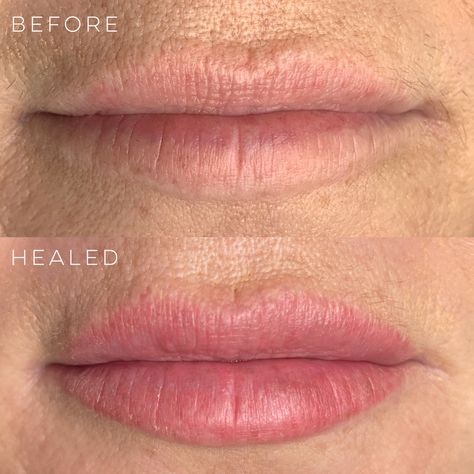 HAIRY— Lip Blush Healing Healed Lip Blush, Permanent Makeup Lips, Lip Color Tattoo, Lip Blushing, Permanent Eyeliner, Korean Makeup Tutorials, Makeup Before And After, Permanent Cosmetics, Lip Blush