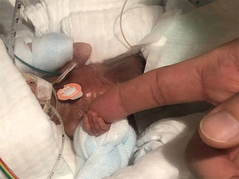 After Spending Months In The Hospital, The World’s Smallest Surviving Premature Baby Has Been Finally Sent Home | Bored Panda Keio University, Emergency C Section, Infant Mortality, Preemie Babies, Baby Hospital, Premature Baby, Small Boy, Baby Tips, Small Baby