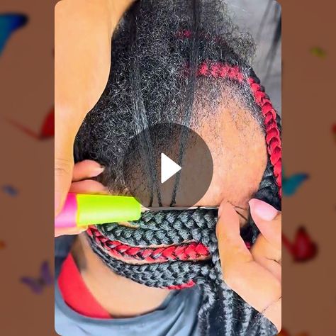 How To: Braids On Alopecia 🙌🏾 To Braids, Alopecia Hairstyles, Lay Lay, Bob Braids, Braids For Black Women, Consumer Health, Braids For Black Hair, Braid Styles, Hair Videos