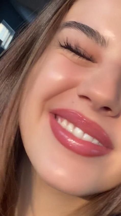 #fyp #trend #viral #straightteeth #teeth Perfect Teeth Smile, Teeth Makeover, Smile White Teeth, V34 Colour Corrector, Teeth Aesthetic, Pretty Teeth, Colour Corrector, Dental Aesthetics, Boyfriend Instagram