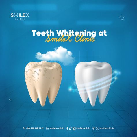 Teeth Whitening Dentist, Discolored Teeth, Straight Teeth, Your Smile, Dental Implants, Medical Advice, Teeth Whitening, Free Photos, Medical