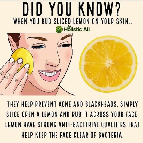 Did You Know? When you rub sliced lemon on your skin Prevent Acne, Natural Health Remedies, Health And Beauty Tips, Health Facts, Health Remedies, Body Health, Natural Healing, Holistic Health, Skin Health