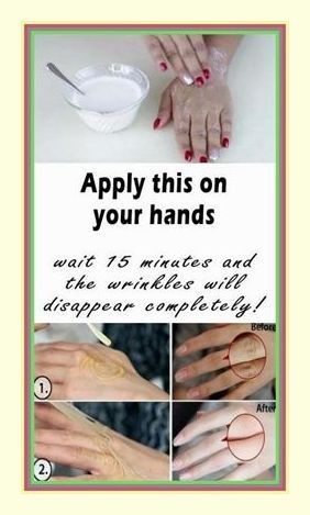 Apply This On Your Hands, Wait 15 Minutes And Wrinkles Disappear Completely! Hand Care Tips, Baking Soda For Dandruff, Baking Soda Shampoo Recipe, Coconut Oil Mask, Wrinkles Hands, Baking Soda For Hair, Anti Aging Hands, Baking Soda Water, Homemade Shampoo