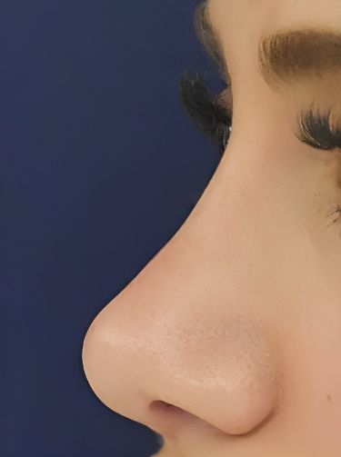 Love your nose! 💖 Find inspiration for nose contouring, makeup, and enhancement. Embrace your unique beauty. #noseinspo #noseaesthetic #selflove #nosebeauty #confidence Contouring Ideas, Nose Profile, Upturned Nose, Nose Types, Straight Eyebrows, Straight Nose, Nose Makeup, Pretty Nose, Perfect Nose