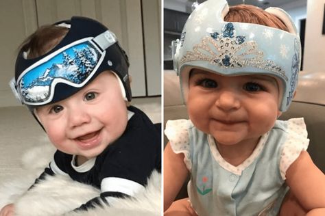 Plagiocephaly Helmets Design, Baby Helmet Design Girls Ideas, Cranial Helmet Designs Boys, Baby Helmet Design Boys, Cranial Helmet Designs, Baby Safety Hacks, Plagiocephaly Helmets, Cranial Helmet, Helmet Painting