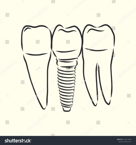 Hand-drawn black lines sketch molar, tooth. Doodle drawing. Object, Element, icon Component for illustration, design b #Ad , #SPONSORED, #Doodle#tooth#drawing#Element Tooth Doodle, Tooth Drawing, Teeth Drawing, Molar Tooth, Line Sketch, Black Lines, Corporate Business, Drawing Challenge, Doodle Drawings