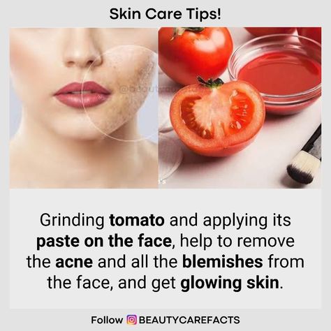 The juice of tomatoes helps in shrinking open pores caused by acne and the natural astringent properties present in tomatoes make it ideal for clearing blemishes. As far as the dark spots on the skin are concerned, the high lycopene content present in tomatoes helps in lightening these stubborn spots. . . Follow @beautycarefacts for natural beauty and health tips. . . Share with your friend👱👱‍♀️ or tag 😉 Double tap❤️ for more info🗣️ share + Tag your Friends. Tomato Mask For Skin, Tomato Benefits Skin, Tomato For Skin, Tomato Benefits, Tomato Mask, Man Pic, Skin Drinks, Open Pores, Tan Removal