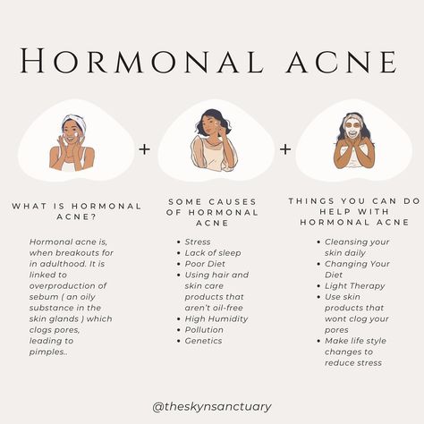 Hormonal acne is when breakouts form in adulthood that could range from blackheads and whiteheads to painful cysts. Hormonal acne is linked to the overproduction of sebum (an oily substance in skin glands), which clogs pores, leading to pimples. Though often unavoidable, hormonal acne can be treated to prevent future breakouts from forming. #hormonalacne #hormonalacnetreatment #hormonebalance #acne #acnesafeproducts #acnefacialtreatment #theskynsanctuary #esthetician #estheticianmeme #estheti... Treating Hormonal Acne, Hormonal Chin Acne, How To Heal Hormonal Acne, How To Clear Hormonal Acne, Esthetics Content, Hormonal Acne Skincare Routine, Hormonal Cystic Acne, Period Pack, Hormonal Acne Diet