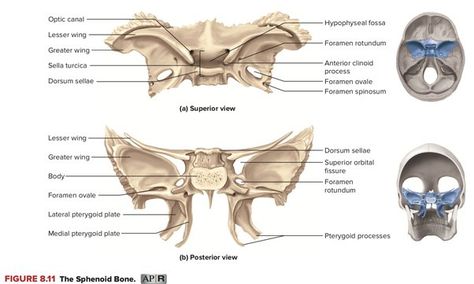 What is the name of the opening between the body and the lesser wing of the sphenoid bone? - Quora Sphenoid Bone Anatomy, Anatomy Diagrams, Sphenoid Bone, School Hacks, The Body, Anatomy, Bones, I Can, Quick Saves