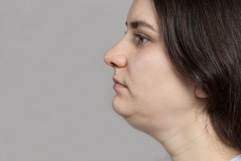 Elongate Neck, Saggy Neck, Double Chin Exercises, Face Yoga Method, Sagging Neck, Chin Exercises, Weight Bearing Exercises, Face Yoga Exercises, Neck Exercises