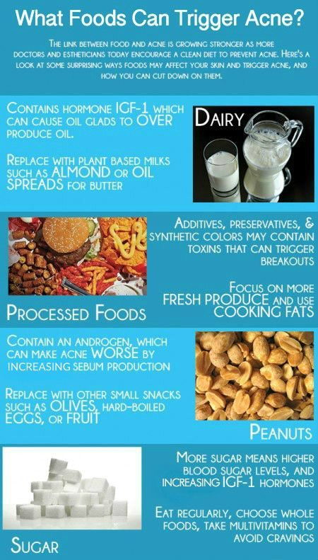 » What Foods Can Trigger Acne? Clear Skin Overnight, Foods For Clear Skin, Acne Diet, Weight Gain Diet, Acne Prone Skin Care, Skin Facts, Acne Face Wash, Clean Diet, Face Acne