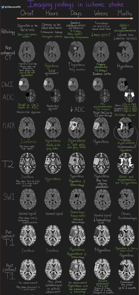 Medical Radiography, Med School Study, Radiology Student, Radiology Technician, Radiology Imaging, Studying Medicine, Medical School Life, Basic Anatomy And Physiology, Medicine Studies