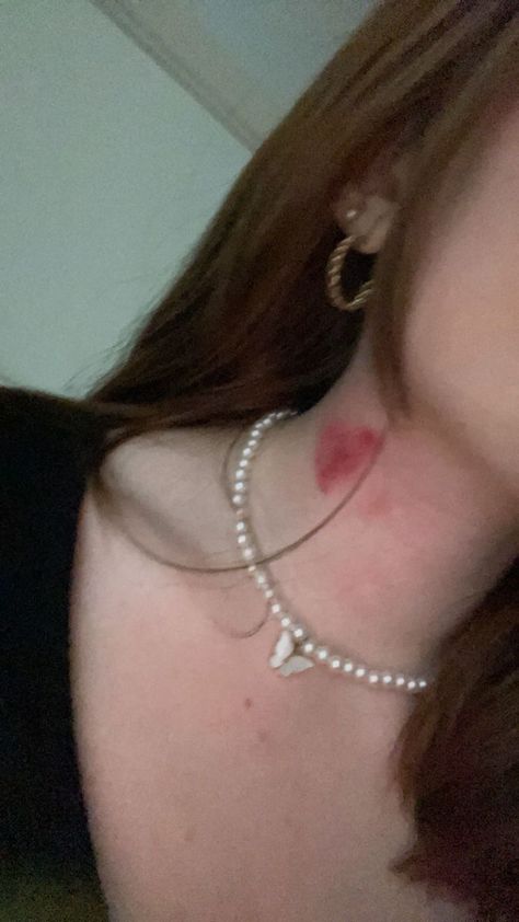 Hickys Neck Girl, Aesthetic Hickey Heart, Aesthetic Pictures Hickey, Neck Of Hickeys, Heart Of Hickies, Hickys Neck Aesthetic, Hickey Chest, Boyfriend Neck Hickey, Love Bite Photos Aesthetic