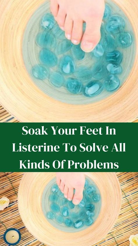 Foot Soak For Smelly Feet Easy Diy, Feet Soak Listerine, How To Get Soft Feet Overnight, Stinky Feet Remedy Foot Odor, Itchy Feet Remedy, Foot Soak Listerine, Listerine Foot Soak Recipe, Cracked Heel Remedy, Smelly Feet Remedies