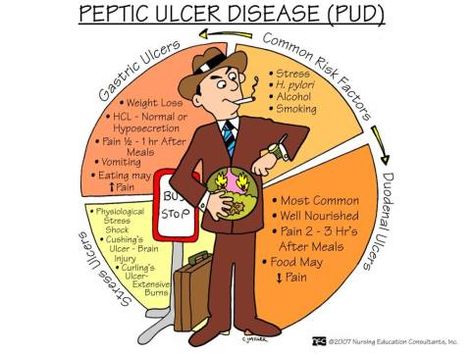 Peptic Ulcer Disease (PUD) Gastrointestinal Nursing, Nursing Hacks, Ultrasound Sonography, Study Info, Health Posters, Nursing Information, Med Surg Nursing, Nclex Prep, Nursing Mnemonics