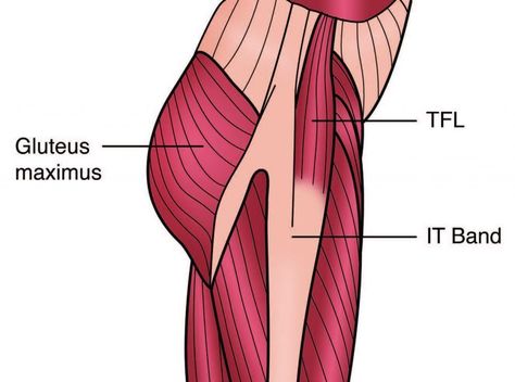 TFL and ITB Anatomy Diagram - El Paso Chiropractor Yoga Poses For Sciatica, Tensor Fasciae Latae, Iliotibial Band, Sciatica Symptoms, Doctor Of Chiropractic, Gluteus Medius, It Band, Knee Pain Relief, Hip Muscles