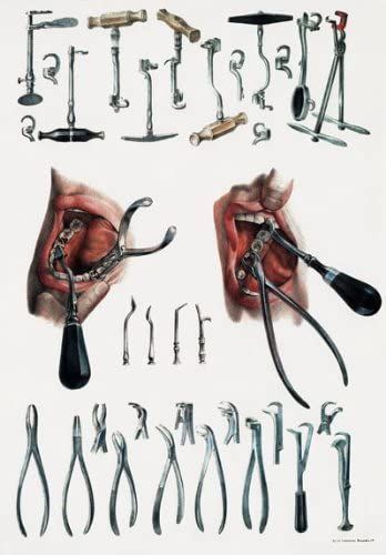 Amazon.com: ML21 Vintage 1800's Medical Dentist Tooth Extraction Dental Tools & Equipment Anatomical Anatomy Poster Re-Print - A4 (297 x 210mm) 11.7" x 8.3": Posters & Prints Tooth Extraction Healing, Dentist Tools, Teeth Whitening Homemade, Emergency Dentist, Dental Art, Tooth Extraction, Dental Teeth, Dental Crowns, Medical Dental