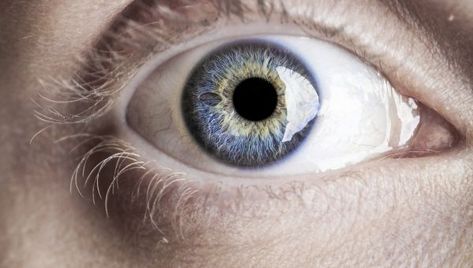 Looking for Stroke Risks in Eyeball Photos - Sharecare People With Black Eyes, People With Brown Eyes, People With Green Eyes, Rare Eye Colors, Rare Eyes, Change Your Eye Color, Blood Pressure Medicine, Wolf Eyes, Amber Eyes