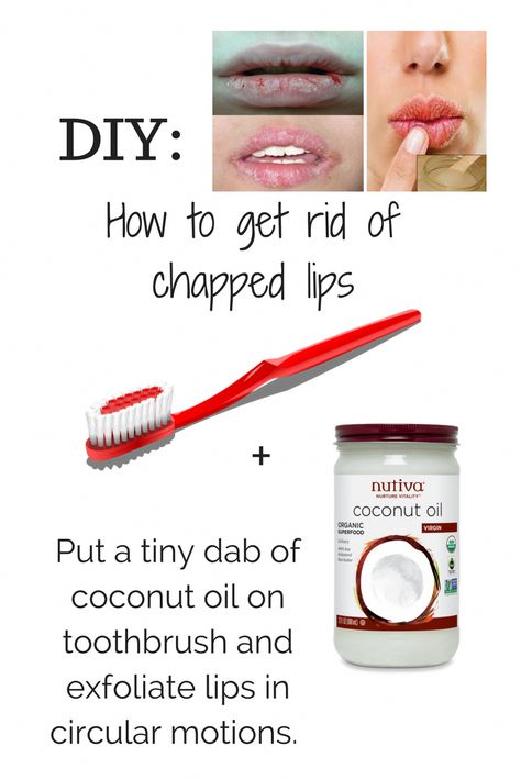 Dry Lips Remedy, Exfoliating Face Scrub, Normal Skin Type, Dry Skin Remedies, Lip Exfoliator, Peeling Skin, Dry Skin Care, Skin Remedies, Chapped Lips