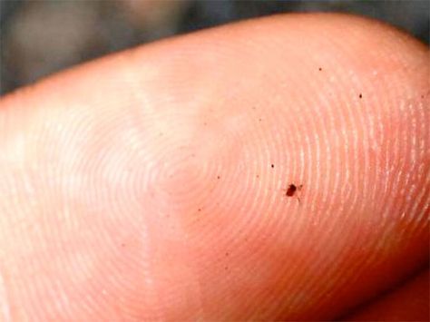 Q: What are red bugs or chiggers and how do you treat their bites? Red Bug Bites, Red Bugs, Red Bug, Wilderness First Aid, Calamine Lotion, Tall Grasses, Fingernail Polish, Bug Bites, Health Guide