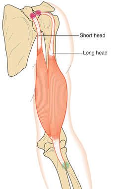 Biceps brachii | definition of biceps brachii by Medical dictionary Arm Anatomy, Biceps Brachii, Medical Dictionary, Medical Terms, Anatomy Art, Medical School, Massage Therapy, Muscles, Anatomy