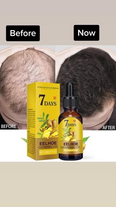 https://healthandbeautynearme.co/products/ginger-hair-growth-products-fast-growing-hair-essential-oil-natural-anti-hair-loss-prevent-hair-dry-frizzy-damaged-repair-care Batman Haircut, Fast Growing Hair, Hair Growth Serums, Ginger Hair Growth, Essential Oil Hair Growth, Accelerate Hair Growth, Essential Oil Beauty, Extreme Hair Growth, Hair Growth Spray