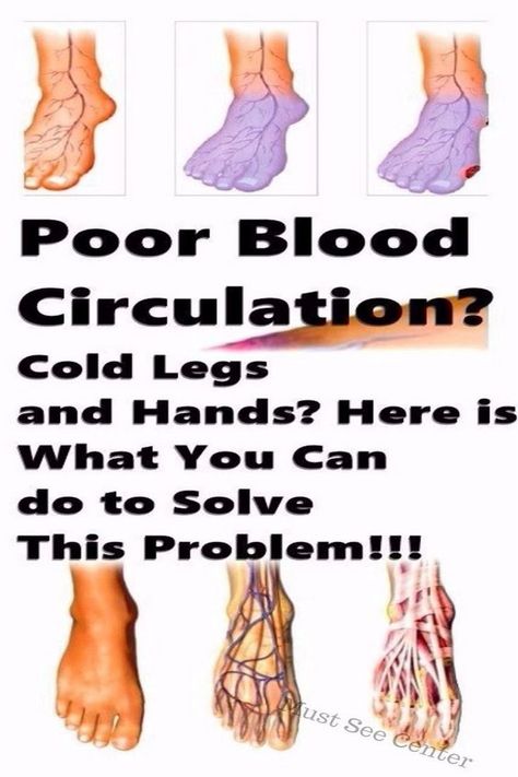 Blood Circulation Remedies, Varicose Vein Remedy, Poor Digestion, Reducing High Blood Pressure, Poor Circulation, Nerve Pain, Cold Hands, More Energy, Good Friends