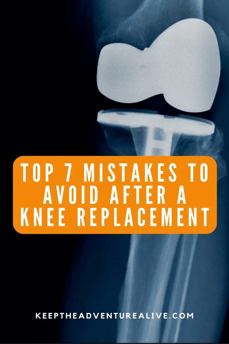 Full Knee Replacement, Knee Replacement Pain, Knee Replacement Surgery Recovery, Knee Replacement Exercises, Knee Replacement Recovery, Knee Pain Relief Remedies, Knee Surgery Recovery, Knee Strengthening Exercises, How To Strengthen Knees