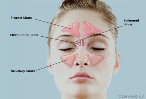 Picture of the Human Sinuses Remedy For Sinus Congestion, Chest Congestion Remedies, Congestion Remedies, Sinus Remedies, Home Remedies For Sinus, Sinus Cavities, Sinus Infection Remedies, Headache Relief Instant, Pitta Dosha