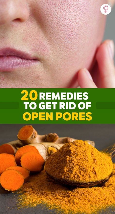 Minimize Pores Naturally, How To Remove Pores, How To Close Pores, Open Pores On Face, Remedy For Sinus Congestion, Get Rid Of Pores, Home Remedies For Sinus, Back Acne Remedies, Big Pores