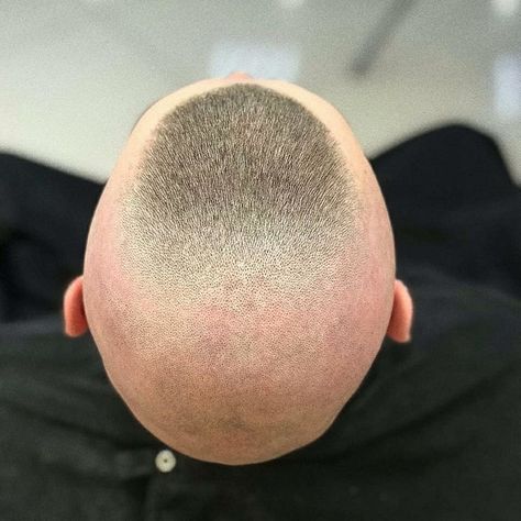 High Bald Fade, Southside Fade, Buzzed Hair Women, Side Fade, High And Tight Haircut, High Skin Fade, Military Haircut, Flat Top Haircut, Clipper Cut