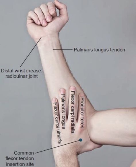 Punkty Spustowe, Physical Therapy School, Human Muscle Anatomy, Studie Hacks, Physical Therapy Student, Physical Therapist Assistant, Physical Therapy Assistant, Medical School Life, Medicine Notes