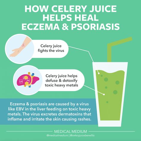 Juicing For Excema, Benefits Of Celery Juice, Foods To Avoid For Excema, Liver Rescue, Medical Medium Celery Juice, Pityriasis Alba, Celery Juice Benefits, Blueberry Powder, Anthony William