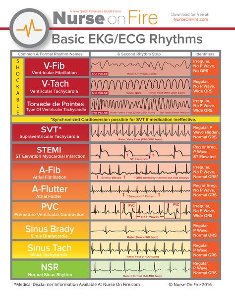 Urgent Care Nurse, Room Basic, Ed Nurse, Heart Rhythm, Nursing School Essential, Nurse Study Notes, Cardiac Nursing, Nursing School Survival, Best Nursing Schools