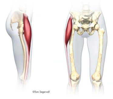 tensor fascia latae TFL muscle Tfl Muscle, Knee Replacement Exercises, Lumbar Lordosis, Femoral Nerve, Tensor Fasciae Latae, Greater Trochanter, Iliotibial Band, Fascia Lata, Hip Strengthening Exercises